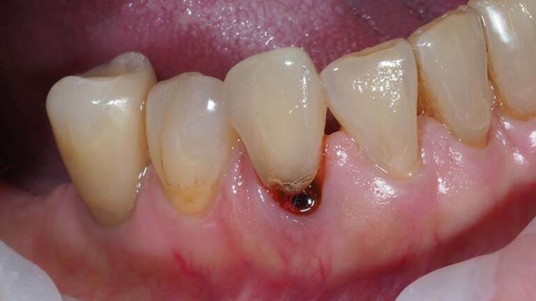 Stomatologia zachowawcza - przed
